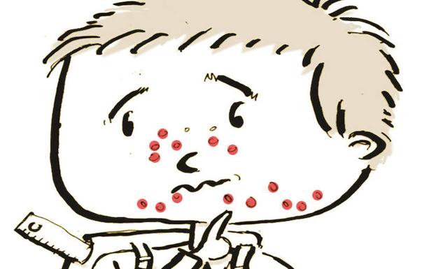 Ilustración de un niño con sarampión.