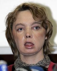 La mujer con el rostro trasplantado, feliz por tener "una cara como todo el mundo"/