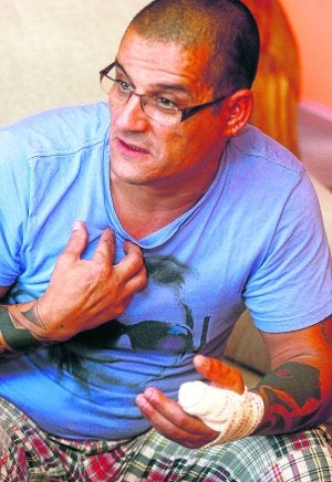 Antonio Sebastián Montero, con el dedo amputado vendado. :: SERGIO LÓPEZ/