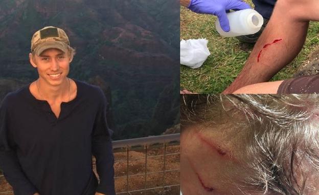 ¿Un hombre con siete vidas?