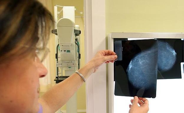 Un error informático con las mamografías podría haber acortado la vida a 270 inglesas
