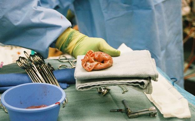 Euskadi, en la vanguardia mundial de la donación de órganos