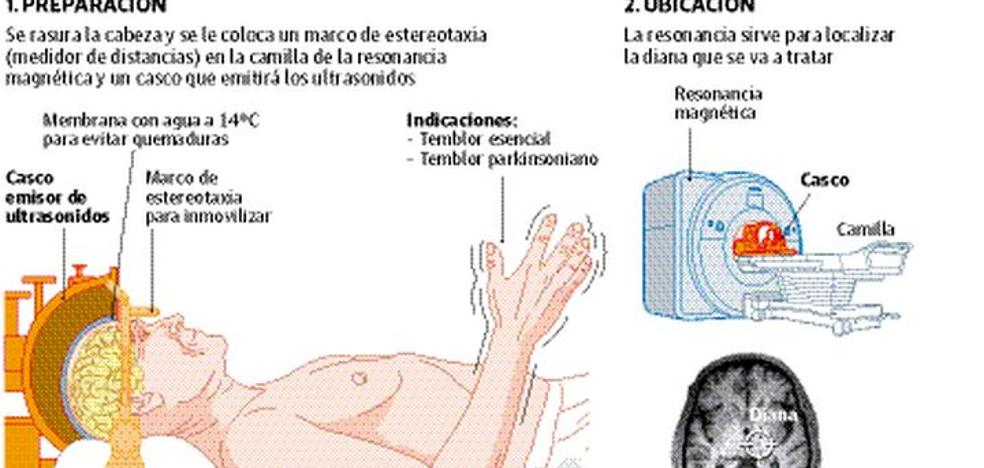 Quitar el temblor de la mano en 20 segundos
