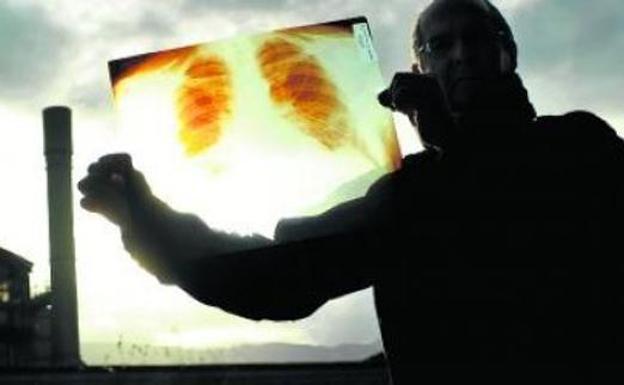 El TSJPV ratifica como enfermedad profesional el cáncer de pulmón de un trabajador guipuzcoano
