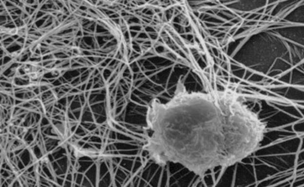 La inmunoterapia es más eficaz en pacientes con metástasis