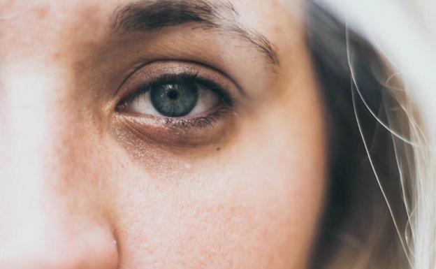 5 remedios para disimular las ojeras