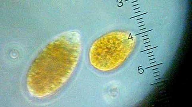 Gipuzkoa inicia la caza del alga tóxica