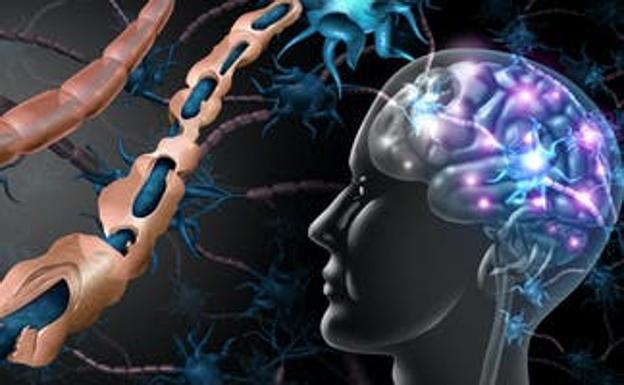 El virus de la enfermedad del beso podría causar la esclerosis múltiple