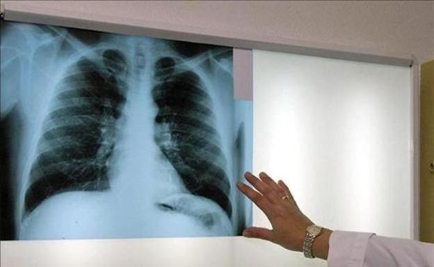 La familia de un fallecido por amianto reclama 136.783 euros a dos empresas