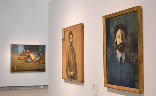 Regreso al artista seriamente enfermo