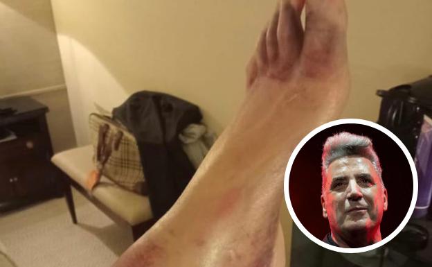 Los fisios de la Real cuidan del tobillo de Loquillo