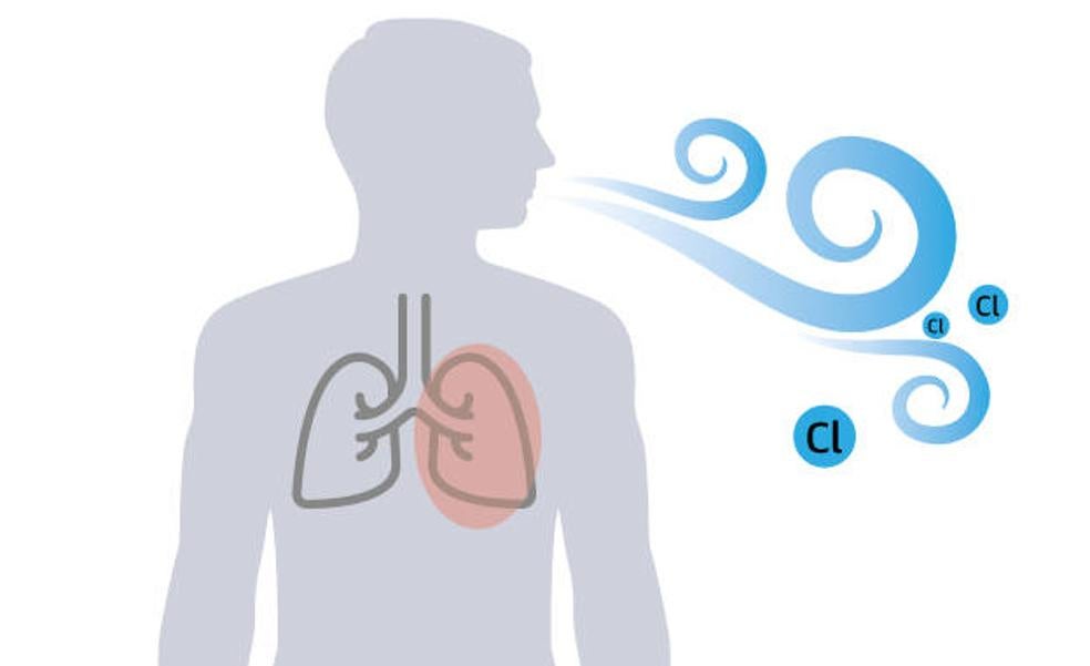 ¿Cuáles son los síntomas de la intoxicación por cloro en una piscina?