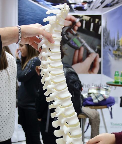 Desarrollan columnas vertebrales 3D personalizadas para operaciones
