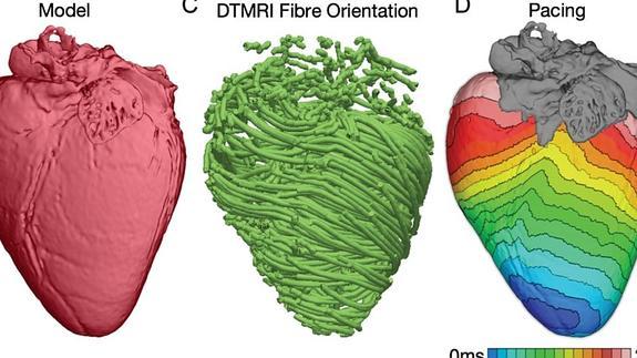 Corazones virtuales para mejorar los tratamientos
