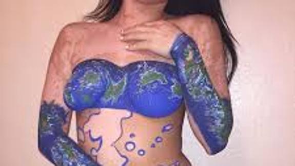 Obras de arte en un cuerpo con vitíligo